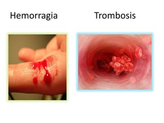 Hemorragia
Trombosis