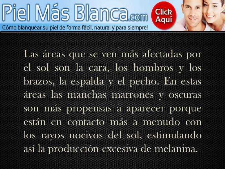 Que cosmética ayuda de las manchas de pigmento