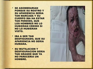  SE ASOMBRARIAN
  PORQUE SU ROSTRO Y
  SU APARIENCIA SERIA
  TAN MARCADA Y SU
  CUERPO IBA HA ESTAR
  TAN PERDIDO, QUE
  LOS HOMBRES NO LO
  HUBIERAN CREIDO SI
  NO LO HUBIERAN
  VISTO.

 IBA A SER TAN
  DESFIGURADO, QUE SU
  APARIENCIA NO SERIA
  HUMANA.

 SU MUTILACION Y
  DESFIGURACION SERIA
  TAN GRANDE QUE YA
  NO PARECERIA UN
  HOMBRE.
 