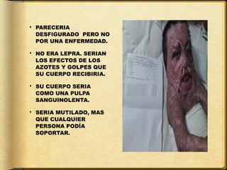  PARECERIA
  DESFIGURADO PERO NO
  POR UNA ENFERMEDAD.

 NO ERA LEPRA. SERIAN
  LOS EFECTOS DE LOS
  AZOTES Y GOLPES QUE
  SU CUERPO RECIBIRIA.

 SU CUERPO SERIA
  COMO UNA PULPA
  SANGUINOLENTA.

 SERIA MUTILADO, MAS
  QUE CUALQUIER
  PERSONA PODÍA
  SOPORTAR.
 