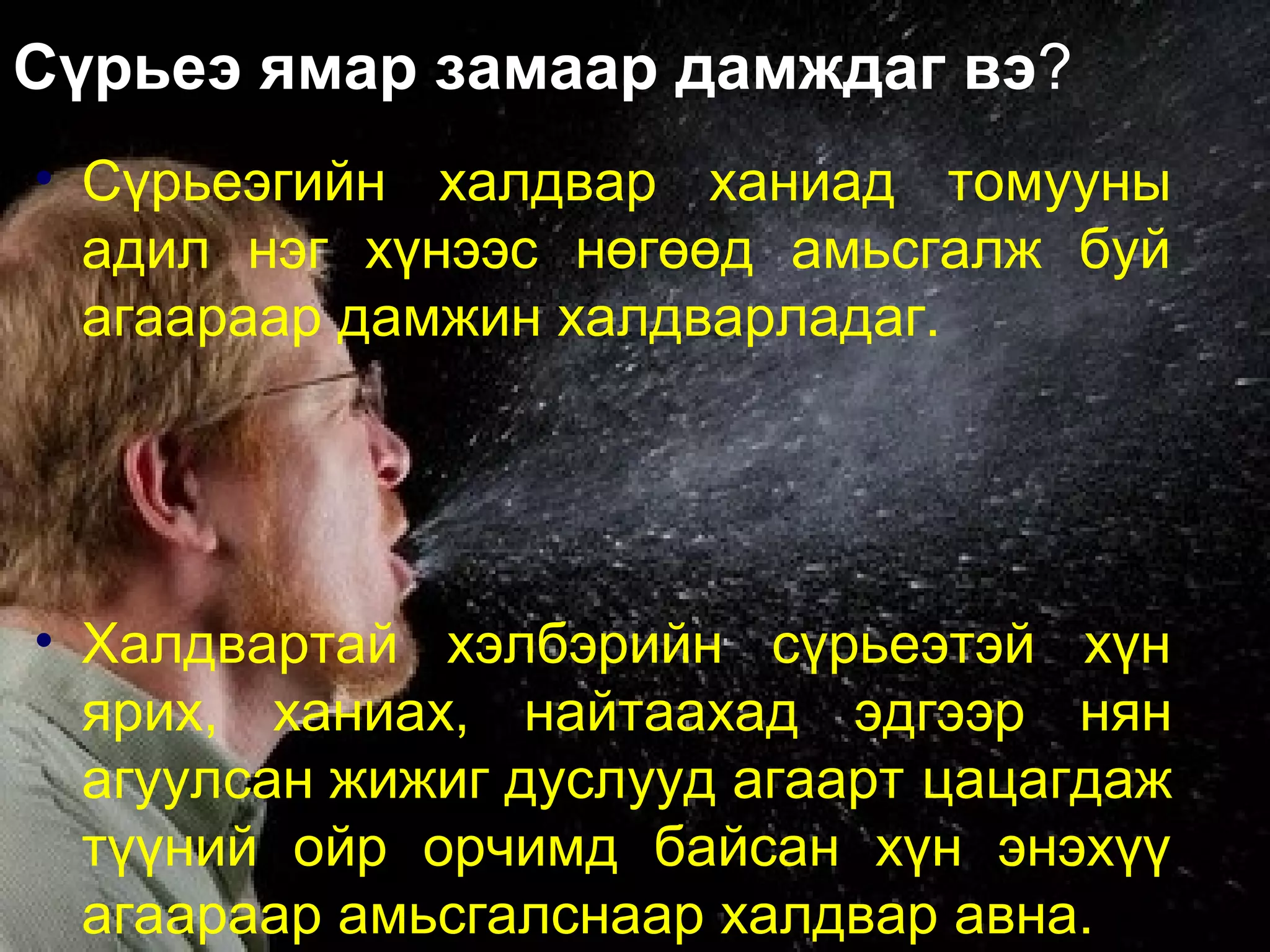 сүрьеэ өвчин | PPT