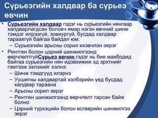 сүрьеэ өвчин | PPT