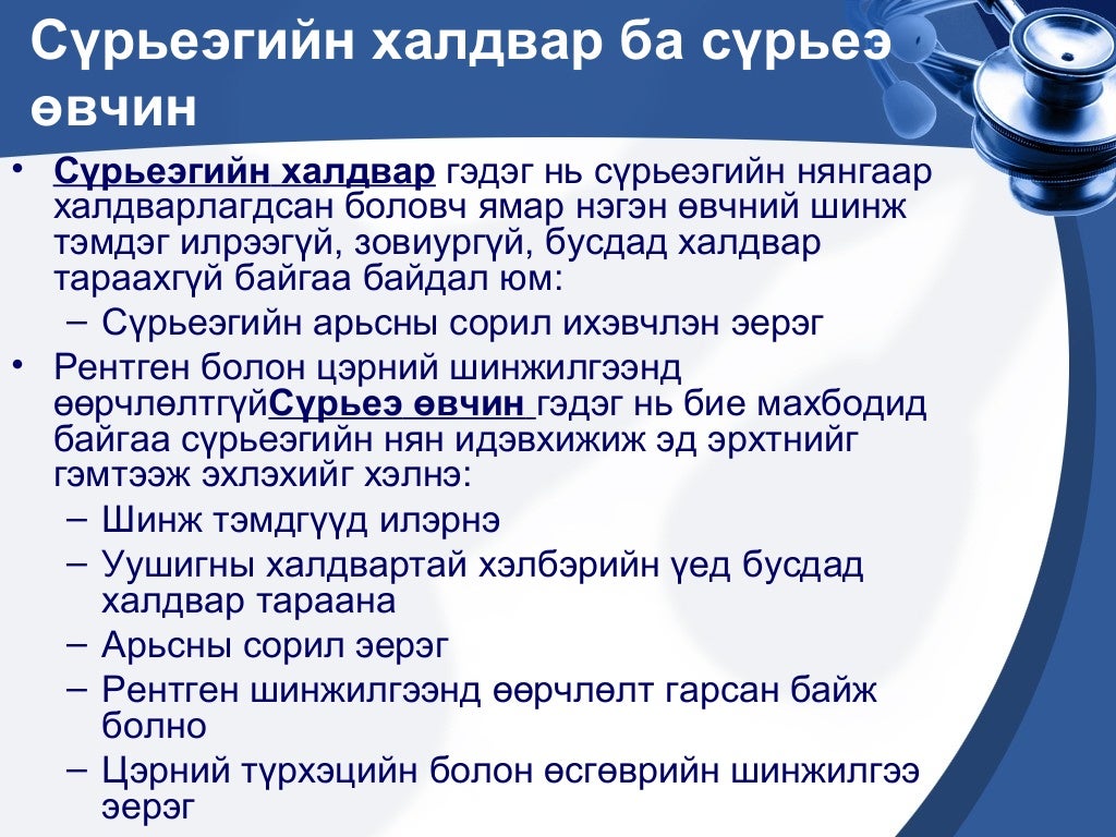 сүрьеэ өвчин