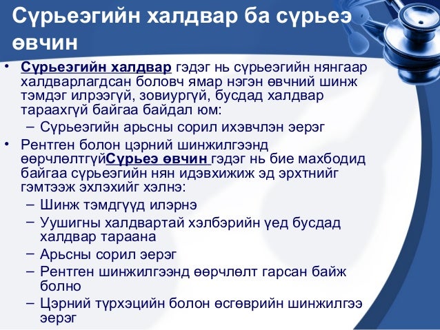 сүрьеэ өвчин