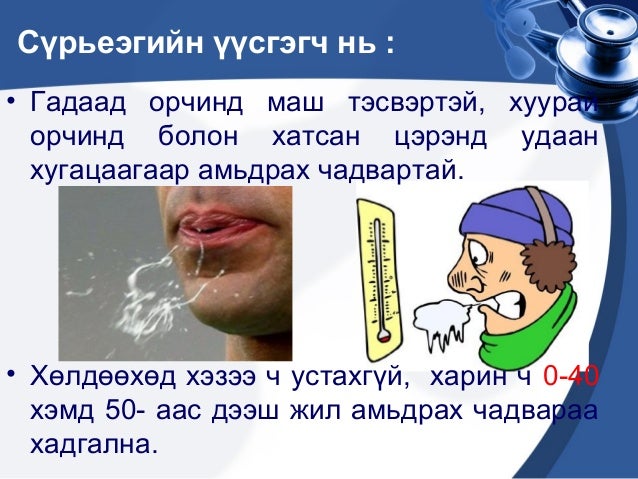 сүрьеэ өвчин