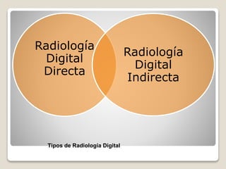 Tipos de Radiología Digital
Radiología
Digital
Directa
Radiología
Digital
Indirecta
 