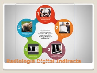 Radiología Digital Indirecta
 