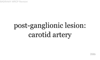 post-ganglionic lesion:
carotid artery
206b
BADRAWY MRCP Revision
 