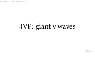 JVP: giant v waves
252a
BADRAWY MRCP Revision
 