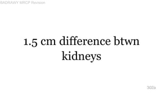 1.5 cm difference btwn
kidneys
302a
BADRAWY MRCP Revision
 
