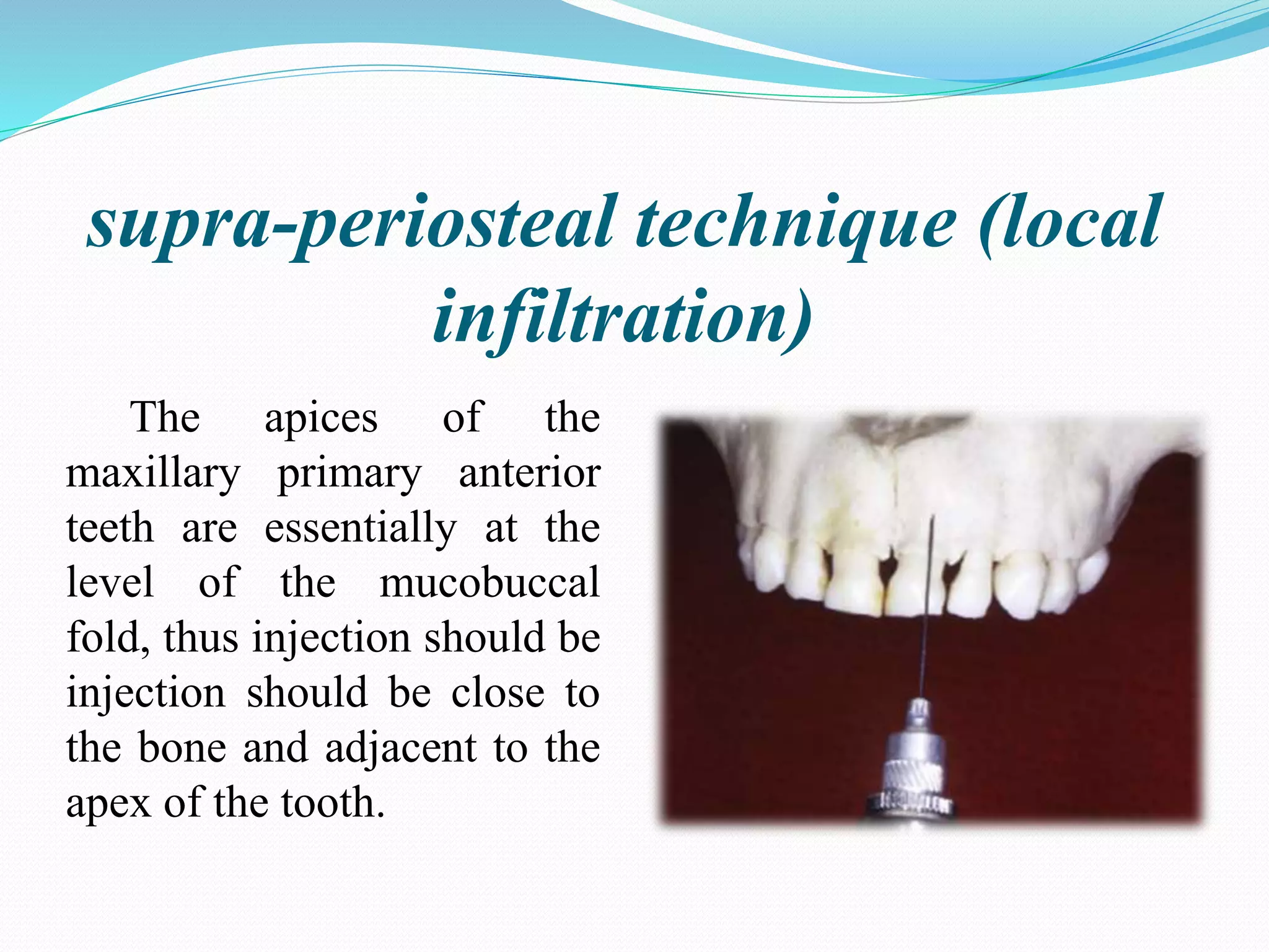Local Anesthesia and Pain Control Pediatric Dentistry by Dr. Ahmed Sami ...