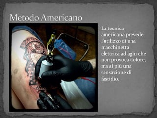 La tecnica
americana prevede
l'utilizzo di una
macchinetta
elettrica ad aghi che
non provoca dolore,
ma al più una
sensazione di
fastidio.
 