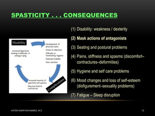 Spacicity Problem Spasticity Management, A rehab art. Hatem S. Shehata | PDF