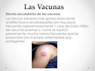 Efectos secundarios de las vacunas
Los efectos adversos más graves (reacciones
anafilácticas o encefalopatía) son muy poco
frecuentes (aproximadamente 1 caso de cada millón
de vacunas puestas) y, como se explicó
previamente, mucho menos frecuentes que los
producidos por la propia enfermedad que
protegemos.
 