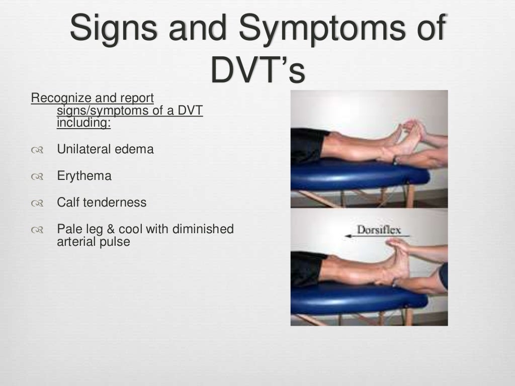 DVT