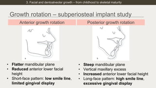 Late facial growth and dentoalveolar remodeling_ considering implant ...
