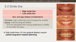 Late facial growth and dentoalveolar remodeling_ considering implant ...