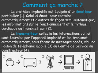 Comment ça marche ?
La prothèse implantée est équipée d'un émetteur
particulier (1). Celui-ci émet, pour certains
automatiquement et d’autres de façon semi-automatique,
les informations sur le fonctionnement et le rythme
cardiaque au transmetteur (2).
Le transmetteur collecte les informations qui lui
sont fournies par l'appareil implanté et les transmet
automatiquement, sous forme de messages codés, via une
liaison de téléphonie mobile (3) au Centre de Service du
constructeur (4).
 