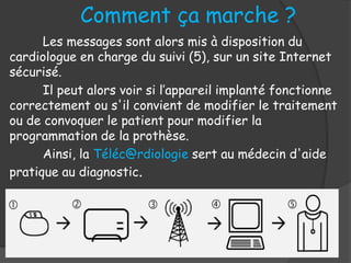 Les messages sont alors mis à disposition du
cardiologue en charge du suivi (5), sur un site Internet
sécurisé.
Il peut alors voir si l’appareil implanté fonctionne
correctement ou s'il convient de modifier le traitement
ou de convoquer le patient pour modifier la
programmation de la prothèse.
Ainsi, la Téléc@rdiologie sert au médecin d'aide
pratique au diagnostic.
Comment ça marche ?
 