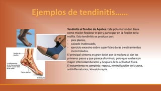 Tendinitis al Tendón de Aquiles. Este potente tendón tiene
como misión flexionar el pie y participar en la flexión de la
rodilla. Esta tendinitis se produce por:
- pies planos,
- calzado inadecuado,
- ejercicio excesivo sobre superficies duras o estiramientos
incontrolados.
El principal síntoma es gran dolor por la mañana al dar los
primeros pasos y que parece disminuir, pero que vuelve con
mayor intensidad durante y después de la actividad física.
El tratamiento es complejo: reposo, inmovilización de la zona,
antiinflamatorios, kinesioterapia.
 