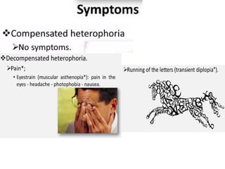 Latent and concomitant strabismus | PPTX