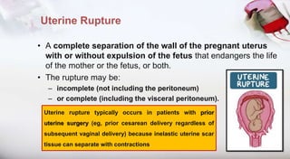 Late pregnancy bleeding Ver2 | PPTX