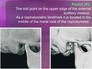 lateral cephalometric analysis in orthodontic | PPT