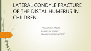 LATERAL CONDYLE FRACTURE
OF THE DISTAL HUMERUS IN
CHILDREN
PRESENTER: Dr. ANIL KC
ORTHOPEDIC RESIDENT
GUANGXI MEDICAL UNIVERSITY
 