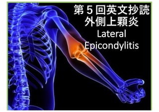 Mejiro Orthopedics and	Internal	medicine Clinic
第５回英文抄読
外側上顆炎
Lateral	
Epicondylitis
 