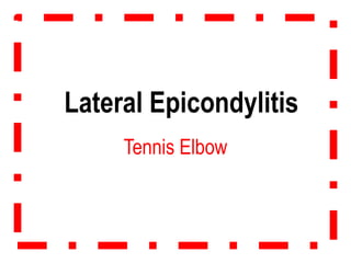 Lateral Epicondylitis
Tennis Elbow
 