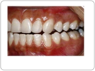 Lateralidad Guía Canina