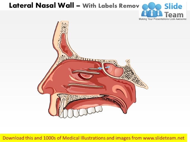 Lateral nasal wall medical images for power point