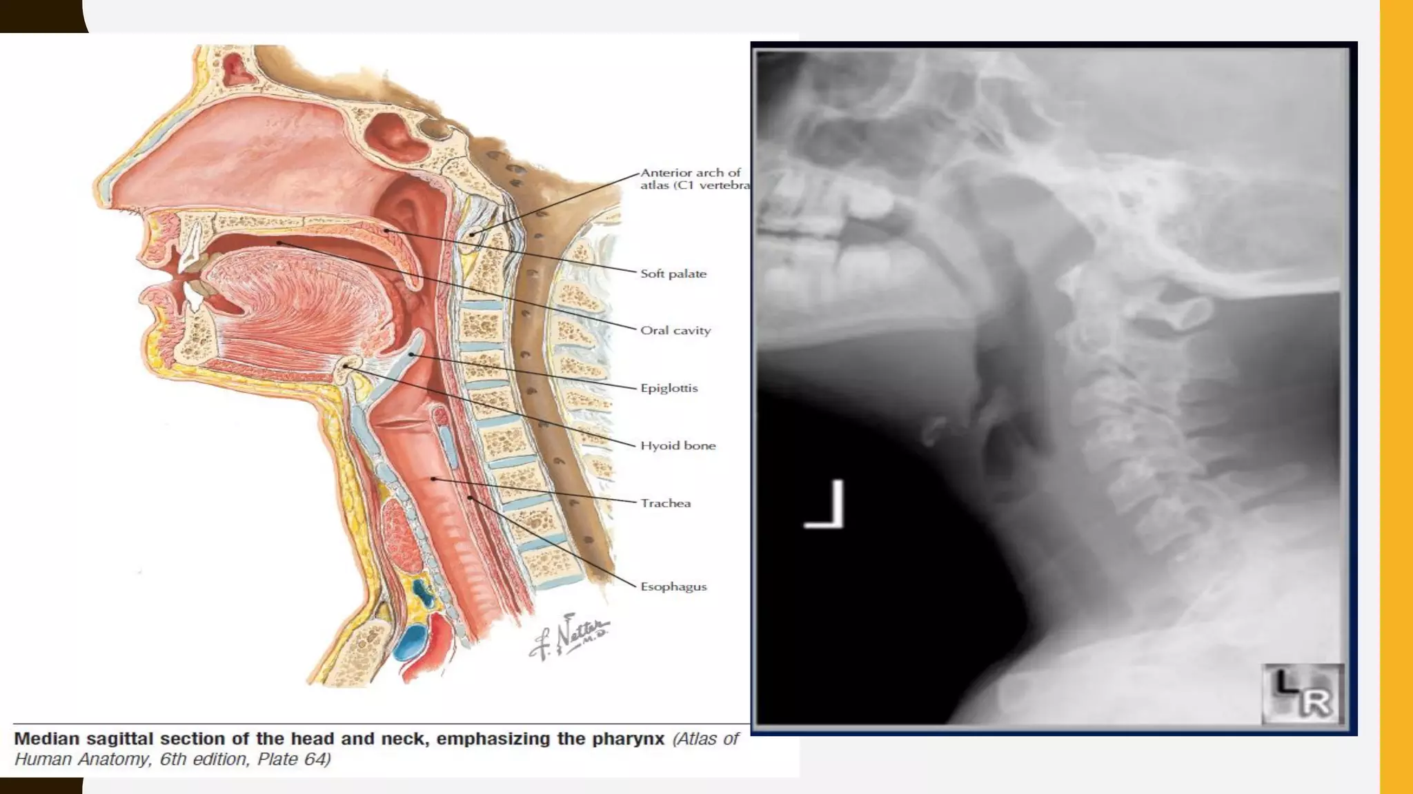 Normal Lateral Neck Lateral neck radiographs | PDF