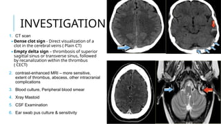 Delta Sign Mri Lateral sinus thrombosis IN ENT AND RELAVANCE .pptx