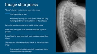 Image sharpness
“Gross” voluntary motion is not seen in the image
Bony trabeculae is seen
A breathing technique is used to blur our rib and lung
markings and improve visualization of the vertebrae
Excessive quantum mottle is not visible on the image
There does not appear to be evidence of double exposure
present
Grids should be used when body parts measure greater than
10 cm
Grid lines, grid artifact and/or grid cut-off is not visible in the
image
A reciprocating/oscillating or high frequency grid was
most likely used for the image
 