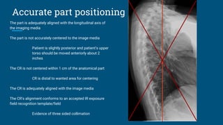 Accurate part positioning
The part is adequately aligned with the longitudinal axis of
the imaging media
The part is not accurately centered to the image media
Patient is slightly posterior and patient’s upper
torso should be moved anteriorly about 2
inches
The CR is not centered within 1 cm of the anatomical part
CR is distal to wanted area for centering
The CR is adequately aligned with the image media
The CR’s alignment conforms to an accepted IR exposure
field recognition template/field
Evidence of three sided collimation
 