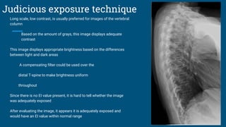 Judicious exposure technique
Long scale, low contrast, is usually preferred for images of the vertebral
column
Based on the amount of grays, this image displays adequate
contrast
This image displays appropriate brightness based on the differences
between light and dark areas
A compensating filter could be used over the
distal T-spine to make brightness uniform
throughout
Since there is no EI value present, it is hard to tell whether the image
was adequately exposed
After evaluating the image, it appears it is adequately exposed and
would have an EI value within normal range
 