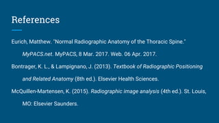 References
Eurich, Matthew. "Normal Radiographic Anatomy of the Thoracic Spine."
MyPACS.net. MyPACS, 8 Mar. 2017. Web. 06 Apr. 2017.
Bontrager, K. L., & Lampignano, J. (2013). Textbook of Radiographic Positioning
and Related Anatomy (8th ed.). Elsevier Health Sciences.
McQuillen-Martensen, K. (2015). Radiographic image analysis (4th ed.). St. Louis,
MO: Elsevier Saunders.
 