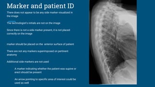 Marker and patient ID
There does not appear to be any side marker visualized in
the image
The technologist’s initials are not on the image
Since there is not a side marker present, it is not placed
correctly on the image
marker should be placed on the anterior surface of patient
There are not any markers superimposed on pertinent
anatomy
Additional side markers are not used
A marker indicating whether the patient was supine or
erect should be present
An arrow pointing to specific area of interest could be
used as well
 