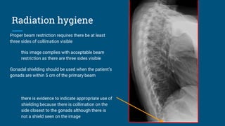 Radiation hygiene
Proper beam restriction requires there be at least
three sides of collimation visible
this image complies with acceptable beam
restriction as there are three sides visible
Gonadal shielding should be used when the patient’s
gonads are within 5 cm of the primary beam
there is evidence to indicate appropriate use of
shielding because there is collimation on the
side closest to the gonads although there is
not a shield seen on the image
 