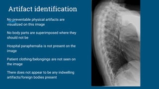 Artifact identification
No preventable physical artifacts are
visualized on this image
No body parts are superimposed where they
should not be
Hospital paraphernalia is not present on the
image
Patient clothing/belongings are not seen on
the image
There does not appear to be any indwelling
artifacts/foreign bodies present
 