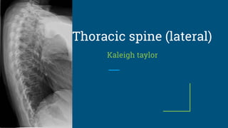 Thoracic spine (lateral)
Kaleigh taylor
 