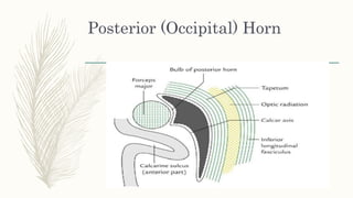 Posterior (Occipital) Horn
 