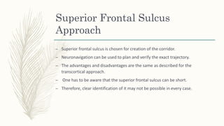 Superior Frontal Sulcus
Approach
– Superior frontal sulcus is chosen for creation of the corridor.
– Neuronavigation can be used to plan and verify the exact trajectory.
– The advantages and disadvantages are the same as described for the
transcortical approach.
– One has to be aware that the superior frontal sulcus can be short.
– Therefore, clear identification of it may not be possible in every case.
 