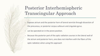Posterior Interhemispheric
Transcingular Approach
– Exposes atrium and the posterior horn of lareral venricle through dissection of
the precuneus, or posterior corpus callosum and cingulate gyrus.
– can be operated on in the prone position.
– Because the posterior part of the optic radiation courses in the lateral wall of
the atrium and posterior horn, one does not interfere with the fibers of the
optic radiation when using this approach
 