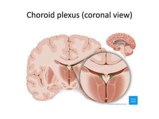 Choroid plexus (coronal view)
 