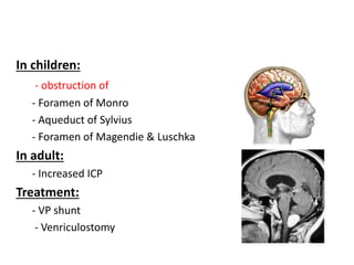 In children:
- obstruction of
- Foramen of Monro
- Aqueduct of Sylvius
- Foramen of Magendie & Luschka
In adult:
- Increased ICP
Treatment:
- VP shunt
- Venriculostomy
 