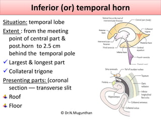Inferior (or) temporal horn
Situation: temporal lobe
Extent : from the meeting
point of central part &
post.horn to 2.5 cm...