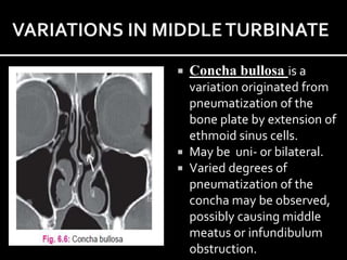 Anatomy of Lateral wall of nose | PPTX