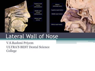 Lateral Wall of Nose
V.S.Rashmi Priyem
ULTRA’S BEST Dental Science
College
 